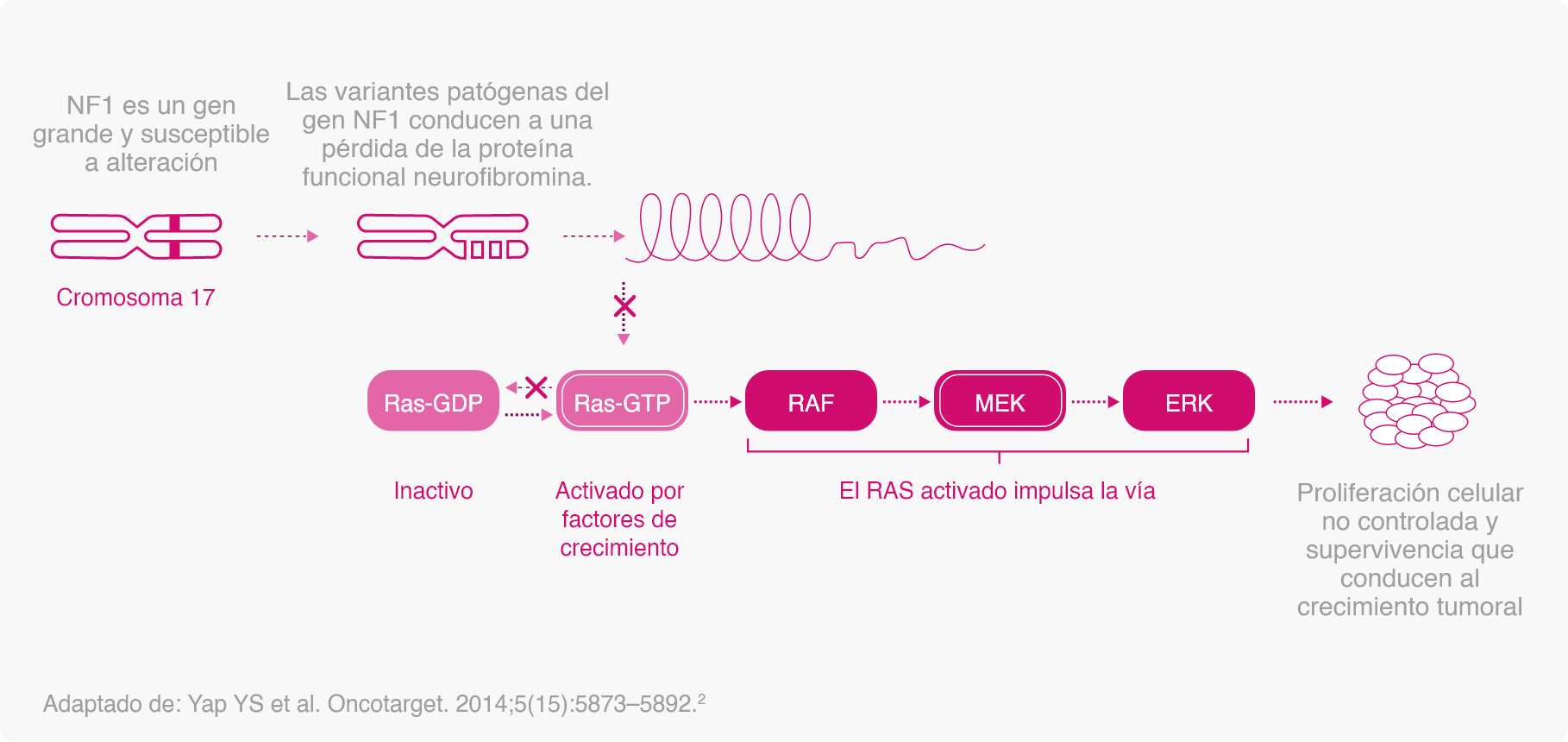 infografia nf1