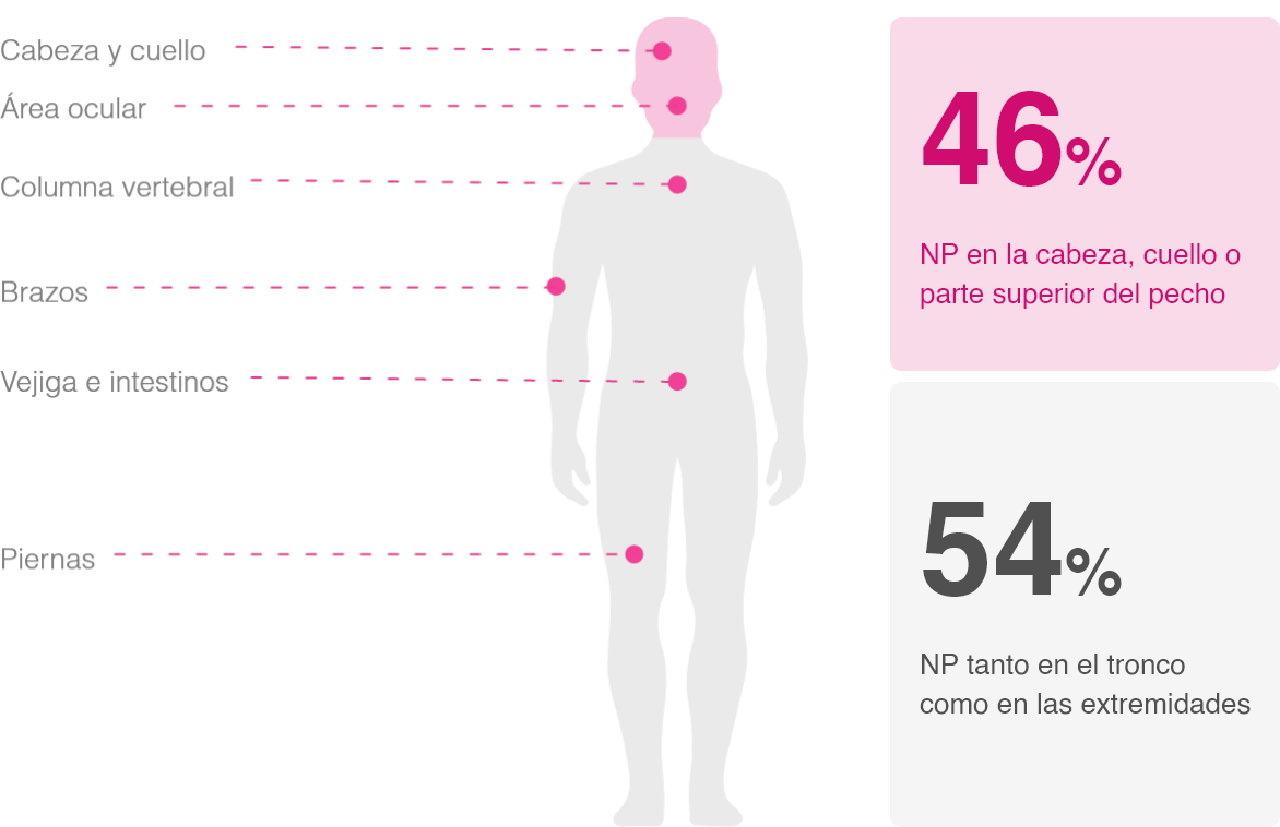 infografia nf1