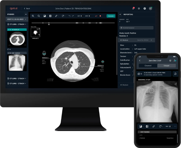 pantallazo de plataforma qure.ai en monitor grande y en pantalla de smartphone